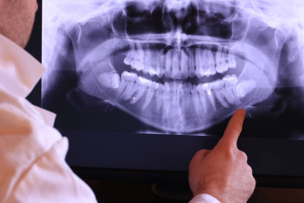 Best Emergency Denture Repair in Englishtown, NJ